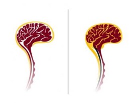 Minnesota Neurosurgery (U of MN, Department of Neurosurgery) entry by Riotto