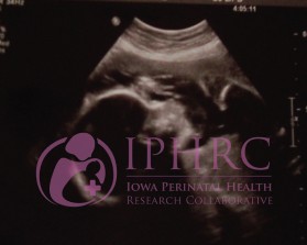 Iowa Perinatal Health Research Collaborative (IPHRC) entry by mv