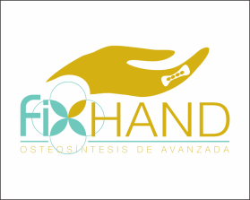 FIX HAND entry by AlexT