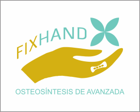 FIX HAND entry by AlexT