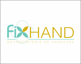 FIX HAND entry by AlexT