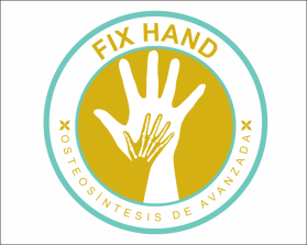 FIX HAND entry by AlexT
