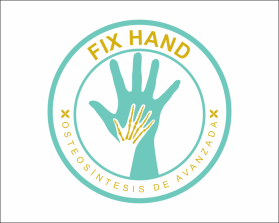 FIX HAND entry by AlexT