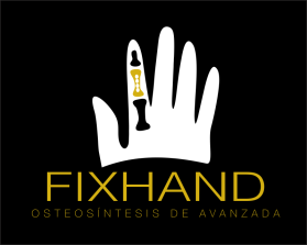 FIX HAND entry by AlexT