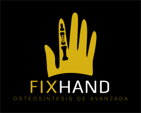 FIX HAND entry by AlexT