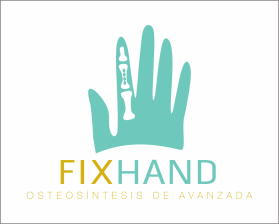 FIX HAND entry by AlexT