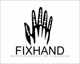 FIX HAND entry by AlexT