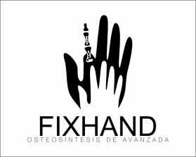 FIX HAND entry by AlexT