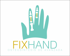 FIX HAND entry by AlexT