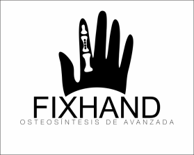 FIX HAND entry by AlexT