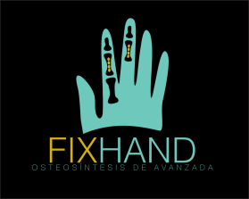 FIX HAND entry by AlexT
