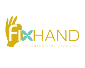 FIX HAND entry by AlexT