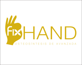 FIX HAND entry by AlexT