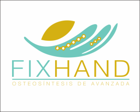 FIX HAND entry by AlexT