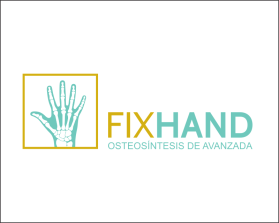 FIX HAND entry by AlexT