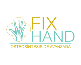 FIX HAND entry by AlexT