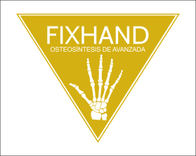 FIX HAND entry by AlexT