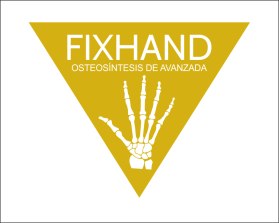 FIX HAND entry by AlexT