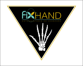 FIX HAND entry by AlexT