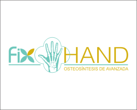 FIX HAND entry by AlexT