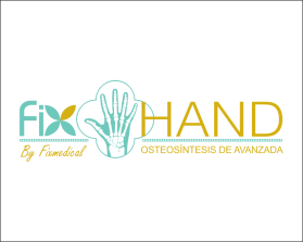 FIX HAND entry by AlexT
