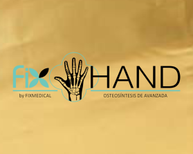 FIX HAND entry by AlexT